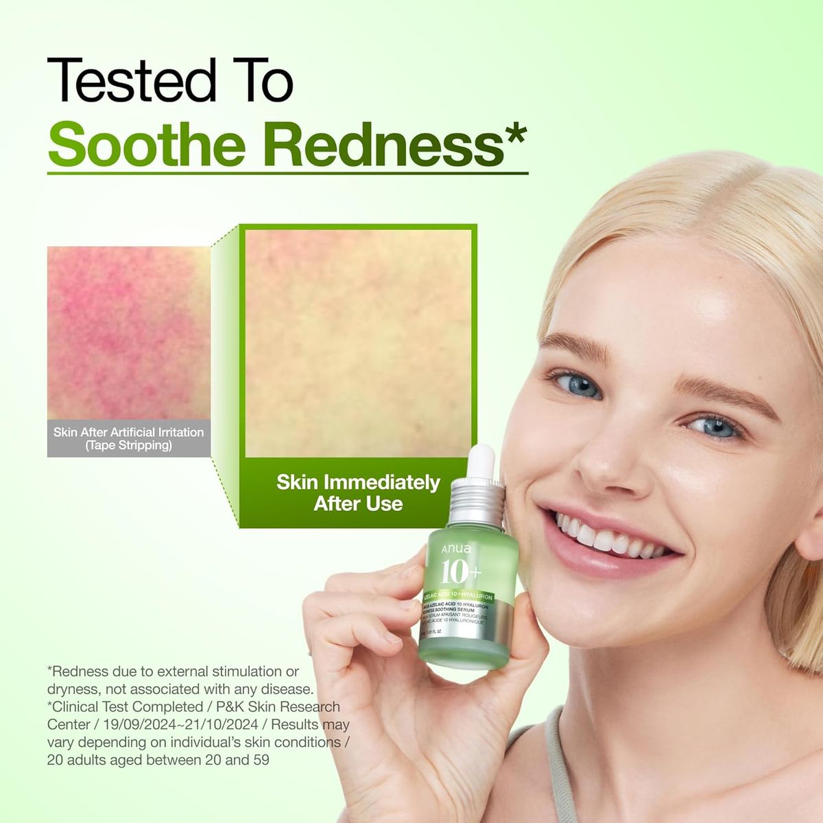 Anua Azelaic Acid 10 Hyaluron Serum: Redness Soothing
