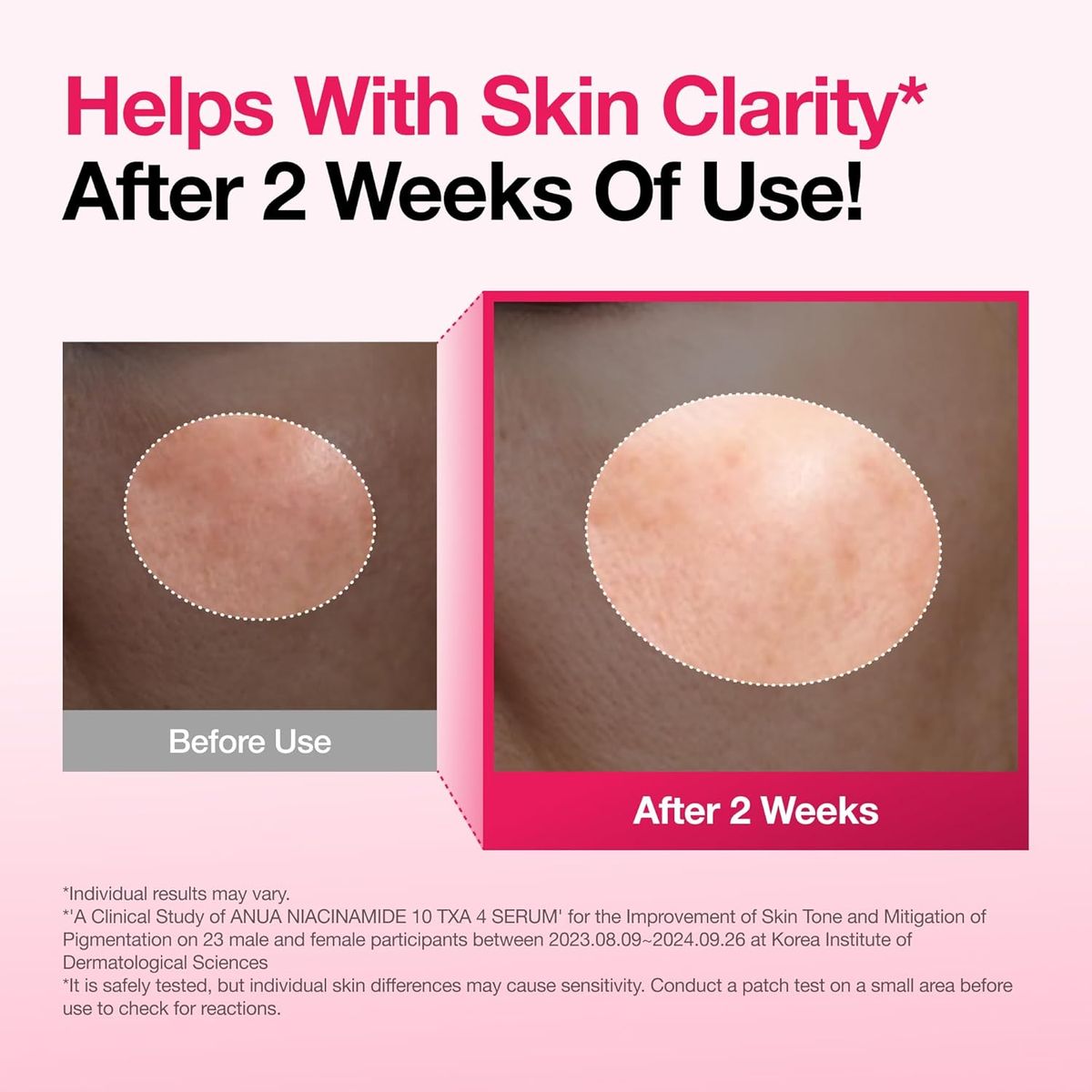 Anua Niacinamide 10 + TXA 4 Serum: The Ultimate Dark Spot Solution