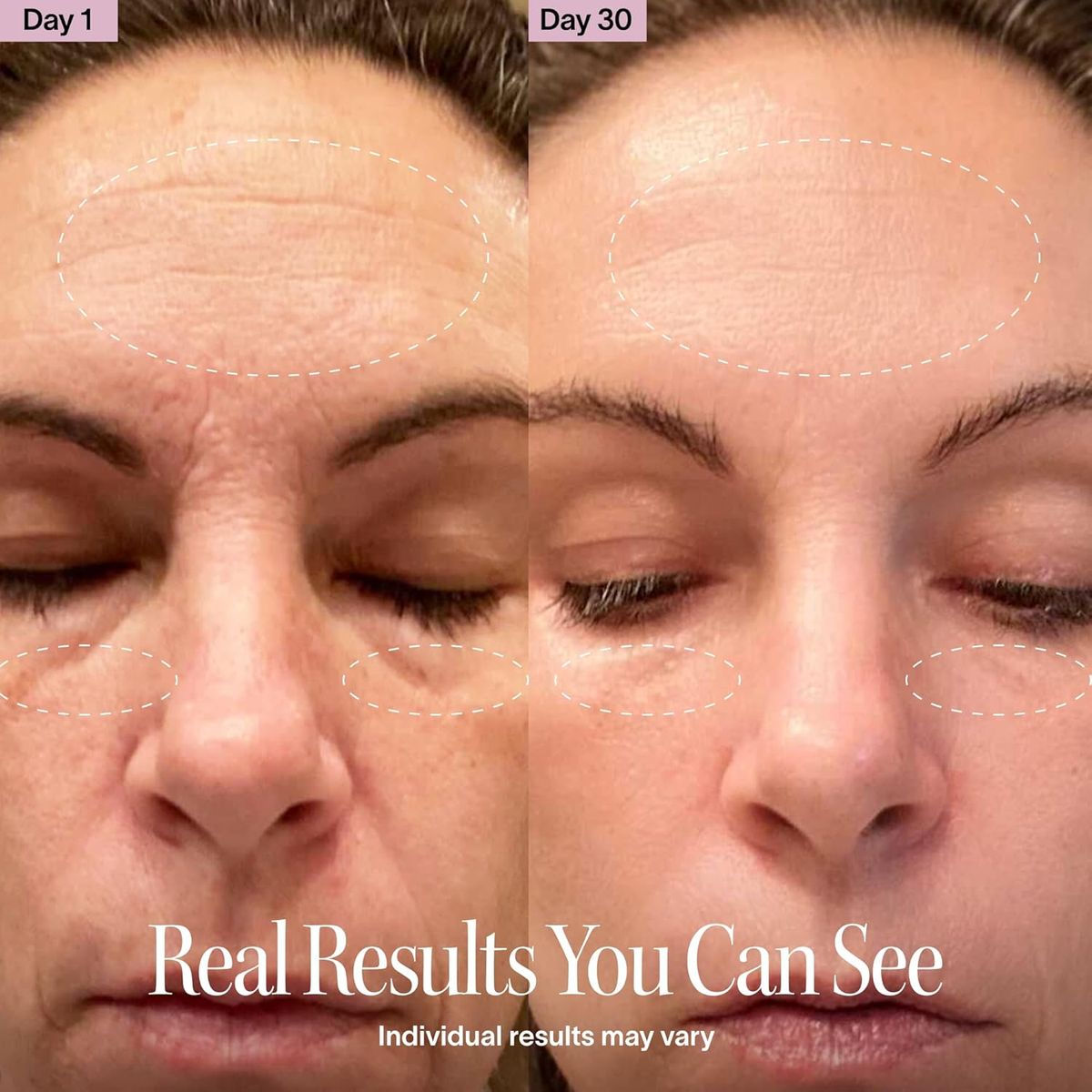 Solawave 4-in-1 Red Light Wand: Your At-Home Facial
