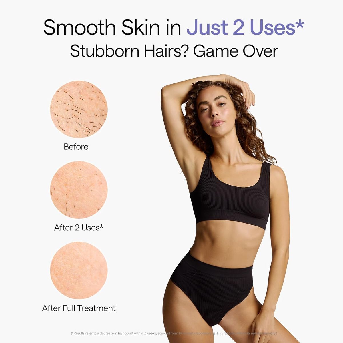 Ulike Air 10 IPL Hair Removal: Ice-Cool, Nearly Painless, Fast